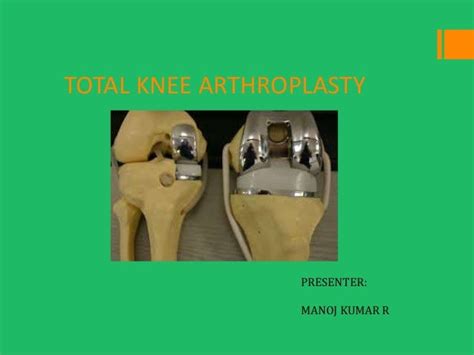 total knee replacement slideshare|TOTAL KNEE REPLACEMENT .